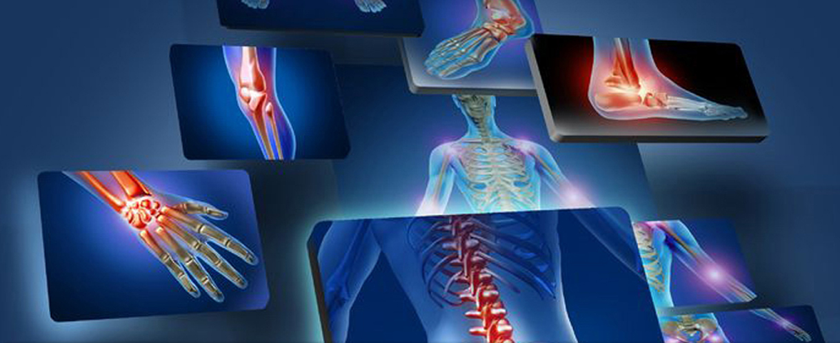 Arthritis Panel Auto Immune & Collage