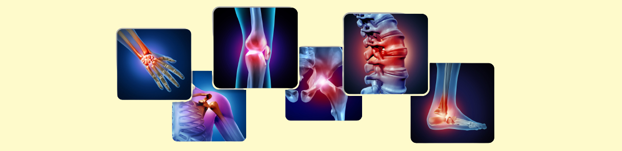 Auto Immune and Collage