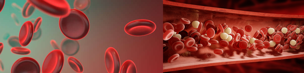 Haemolytic Anemia