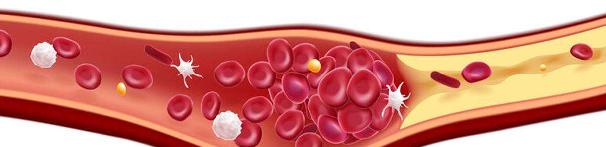 Thromnophillia & Therombosis Panel